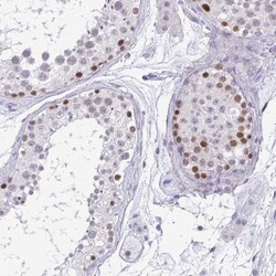 TIPIN Antibody, Novus Biologicals 25 &mu;L, Unlabeled:Antibodies, Polyclonal