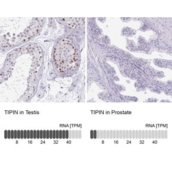 TIPIN Antibody, Novus Biologicals 25 &mu;L, Unlabeled:Antibodies, Polyclonal