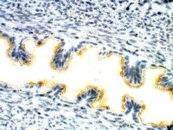 TIPIN Antibody, Novus Biologicals 100 &mu;g | Buy Online | Bio-Techne | Fisher Scientific