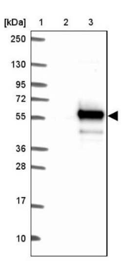 TIPIN Antibody, Novus Biologicals 25 &mu;L, Unlabeled:Antibodies, Polyclonal