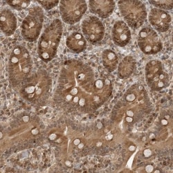 TIPRL Antibody, Novus Biologicals:Antibodies:Primary Antibodies