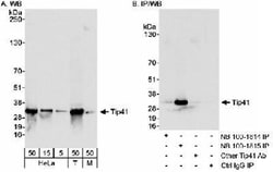 TIPRL Antibody, Novus Biologicals 0.1mL; Unlabeled:Antibodies, Polyclonal