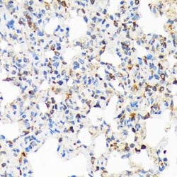 TIRAP Rabbit anti-Human, Mouse, Rat, Clone: 9T1A8, Novus Biologicals 20