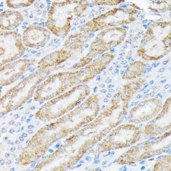 TIRAP Rabbit anti-Human, Mouse, Rat, Clone: 9T1A8, Novus Biologicals 20