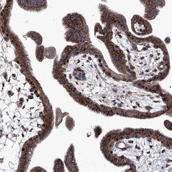 TJAP1 Antibody, Novus Biologicals:Antibodies:Primary Antibodies