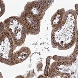 TJAP1 Antibody, Novus Biologicals:Antibodies:Primary Antibodies