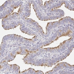 TJP3 Antibody, Novus Biologicals 0.1 mL | Buy Online | Novus Biologicals | Fisher Scientific