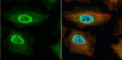 TKTL1 Antibody, Novus Biologicals 0.1mL; Unlabeled:Antibodies, Polyclonal