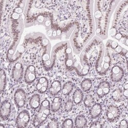 TLE3 Antibody, Novus Biologicals:Antibodies:Primary Antibodies