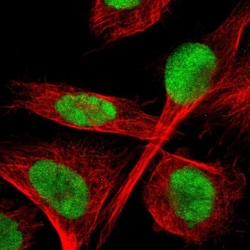 TLK1 Antibody, Novus Biologicals 25 &mu;L; Unlabeled:Antibodies, Polyclonal