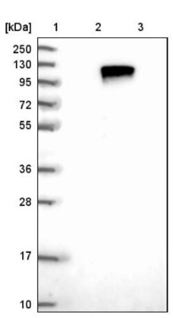 TLK1 Antibody, Novus Biologicals 25 &mu;L; Unlabeled:Antibodies, Polyclonal