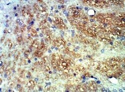 TLR13 Antibody, Novus Biologicals 100 &mu;g | Buy Online | Novus Biologicals | Fisher Scientific