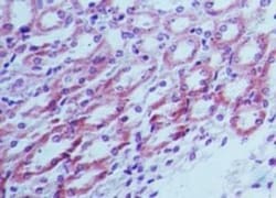 TLR4 Antibody, Novus Biologicals 0.025mg; Unlabeled:Antibodies, Polyclonal
