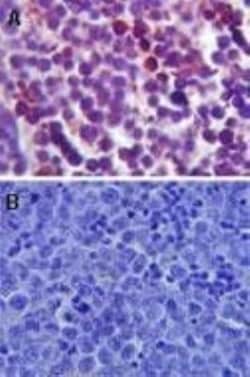 TLR4 Antibody - BSA Free, Novus Biologicals 0.1mL; Unlabeled:Antibodies,
