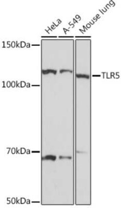 TLR5 Rabbit anti-Human, Mouse, Clone: 6P1Q10, Novus Biologicals 100 &mu;g;