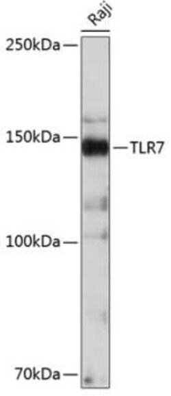 TLR7 Rabbit anti-Human, Clone: 3G6S4, Novus Biologicals 100 &mu;g; Unconjugated:Antibodies,