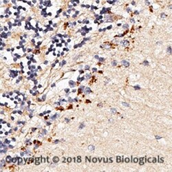 TLR7 Antibody, Novus Biologicals 0.025mg; Unlabeled:Antibodies, Polyclonal