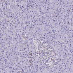 TLR7 Antibody, Novus Biologicals:Antibodies:Primary Antibodies