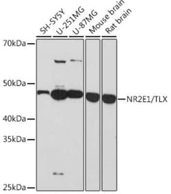 TLX/NR2E1 Rabbit anti-Human, Mouse, Rat, Clone: 6P3H8, Novus Biologicals:Antibodies:Primary