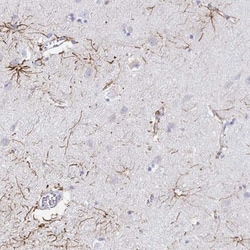 TLX/NR2E1 Antibody, Novus Biologicals 25 &mu;L, Unlabeled:Antibodies, Polyclonal