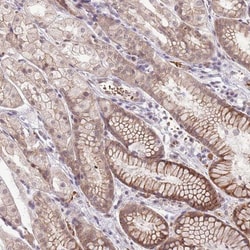 TM2D1 Antibody, Novus Biologicals 25 &mu;L, Unlabeled:Antibodies, Polyclonal