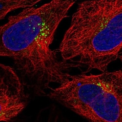 TM9SF1 Antibody, Novus Biologicals 0.1mL; Unlabeled:Antibodies, Polyclonal