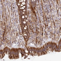 TM9SF4 Antibody, Novus Biologicals 0.1mL; Unlabeled:Antibodies, Polyclonal