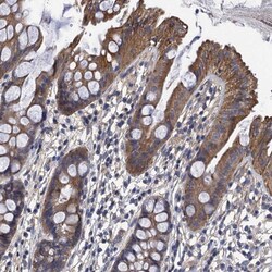 DAN/NBL1 Antibody, Novus Biologicals:Antibodies:Primary Antibodies