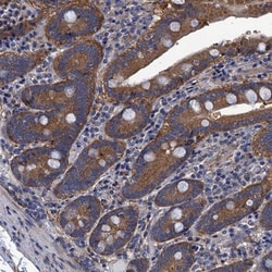 DAN/NBL1 Antibody, Novus Biologicals:Antibodies:Primary Antibodies