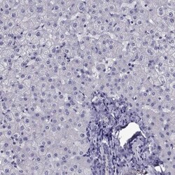DAN/NBL1 Antibody, Novus Biologicals:Antibodies:Primary Antibodies