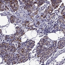 DAN/NBL1 Antibody, Novus Biologicals:Antibodies:Primary Antibodies