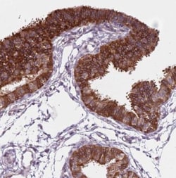 TMC4 Antibody, Novus Biologicals:Antibodies:Primary Antibodies