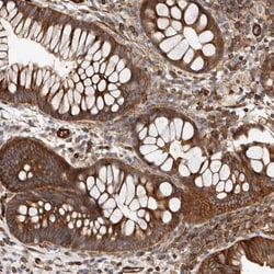 TMC7 Antibody, Novus Biologicals:Antibodies:Primary Antibodies