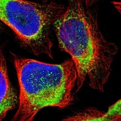 TMCC3 Antibody, Novus Biologicals 0.1mL; Unlabeled:Antibodies, Polyclonal