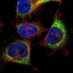 TMCC3 Antibody, Novus Biologicals 0.1mL; Unlabeled:Antibodies, Polyclonal