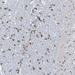 TMCC3 Antibody, Novus Biologicals 0.1mL; Unlabeled:Antibodies, Polyclonal