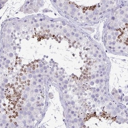 TMCO5 Antibody, Novus Biologicals:Antibodies:Primary Antibodies