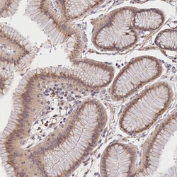 TMCO7 Antibody, Novus Biologicals 0.1mL; Unlabeled:Antibodies, Polyclonal