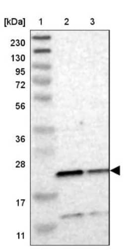 TMED2 Antibody, Novus Biologicals:Antibodies:Primary Antibodies