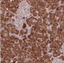 TMED6 Antibody, Novus Biologicals 0.1 mL | Buy Online | Novus Biologicals | Fisher Scientific