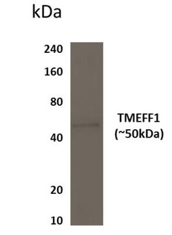TMEFF1/Tomoregulin-1 Antibody (MM0571-7S12) - Azide and BSA Free, Novus Biologicals 0.1 mg | Buy Online | Novus Biologicals | Fisher Scientific