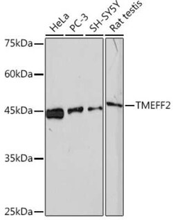 TMEFF2/Tomoregulin-2 Rabbit anti-Human, Rat, Clone: 6K5Q9, Novus Biologicals 100 &mu;g | Buy Online | Novus Biologicals | Fisher Scientific