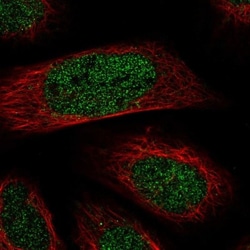 TMEM104 Antibody, Novus Biologicals 25 &mu;L, Unlabeled:Antibodies, Polyclonal