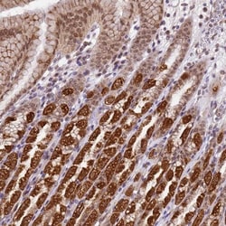 TMEM104 Antibody, Novus Biologicals 25 &mu;L, Unlabeled:Antibodies, Polyclonal