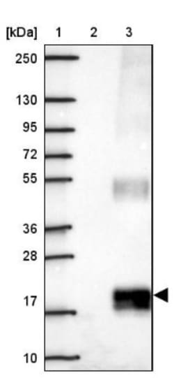 TMEM104 Antibody, Novus Biologicals 25 &mu;L, Unlabeled:Antibodies, Polyclonal
