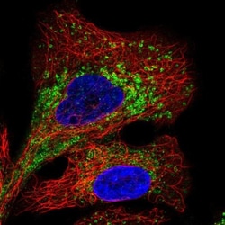 TMEM106B Antibody, Novus Biologicals 0.1mL; Unlabeled:Antibodies, Polyclonal