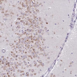 TMEM106B Antibody, Novus Biologicals 0.1mL; Unlabeled:Antibodies, Polyclonal