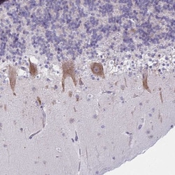 TMEM106B Antibody, Novus Biologicals 0.1mL; Unlabeled:Antibodies, Polyclonal
