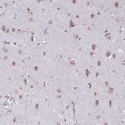TMEM106B Antibody, Novus Biologicals 0.1mL; Unlabeled:Antibodies, Polyclonal