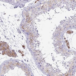 TMEM106B Antibody, Novus Biologicals 0.1mL; Unlabeled:Antibodies, Polyclonal